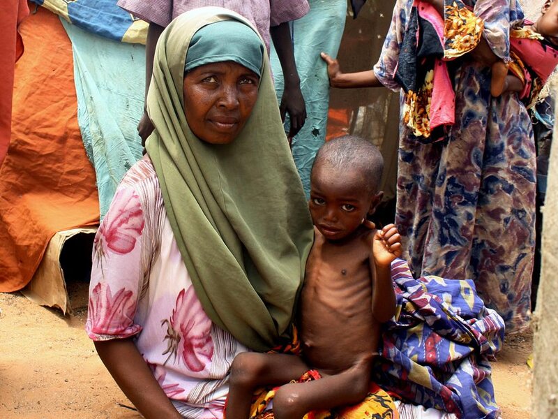 Woman Holding Malnourished Child