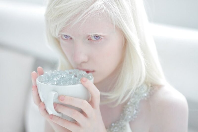 woman with albinism holding cup