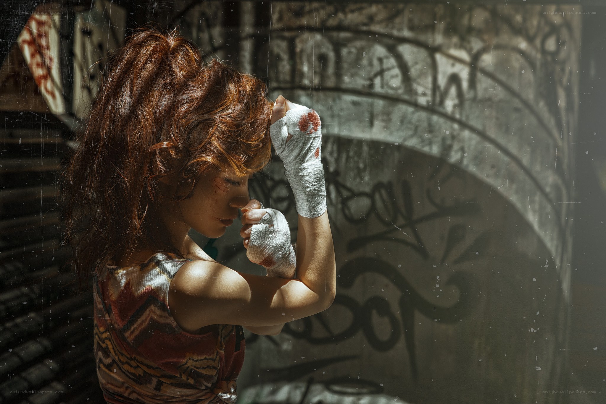 woman with bandaged hands