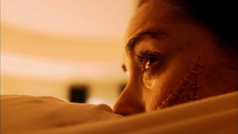 woman with facial scar