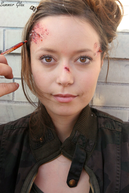 woman with fake injuries