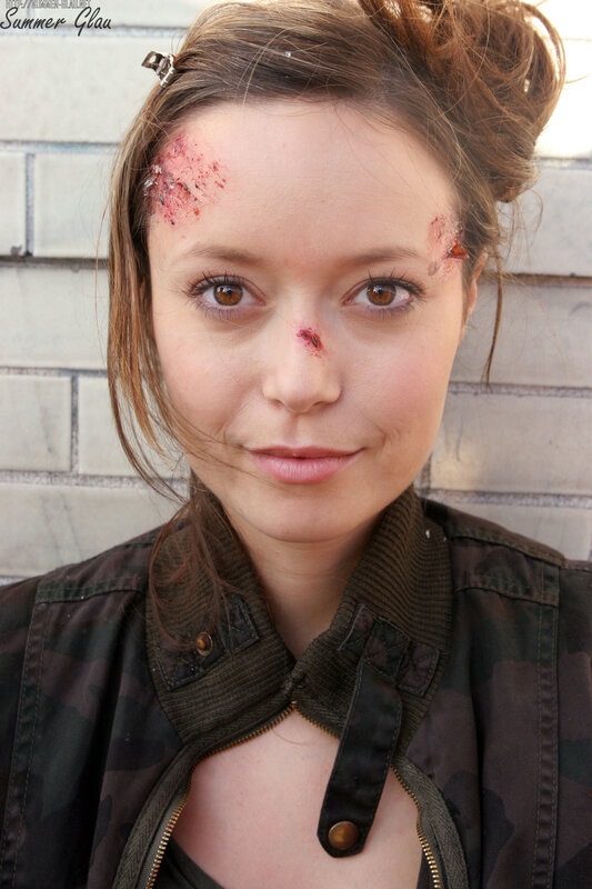 woman with fake injuries