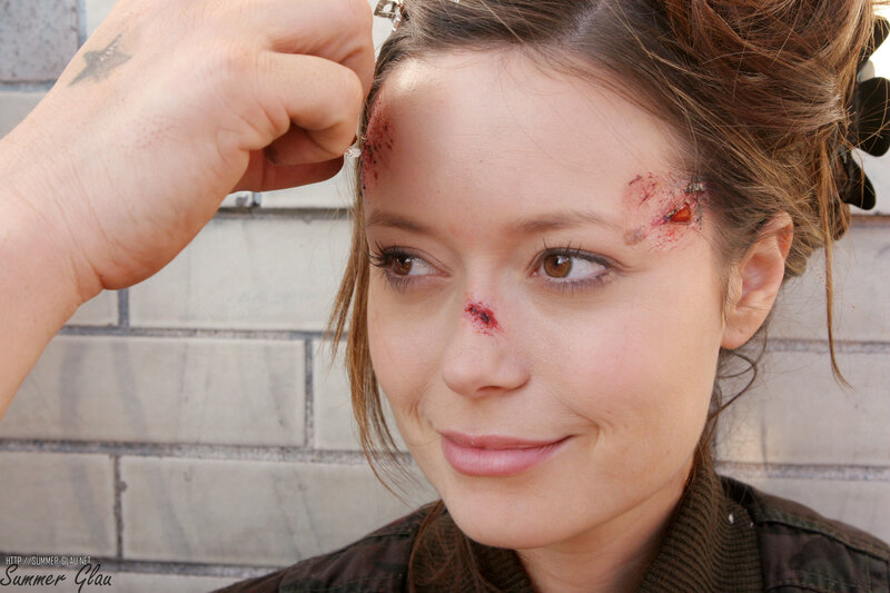 woman with fake injuries