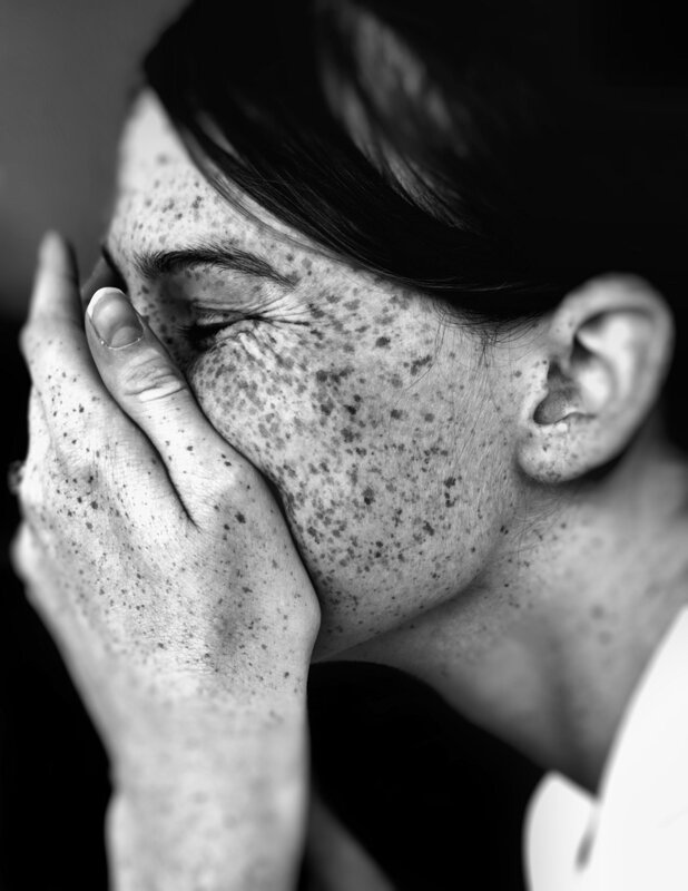 woman with freckles covering face