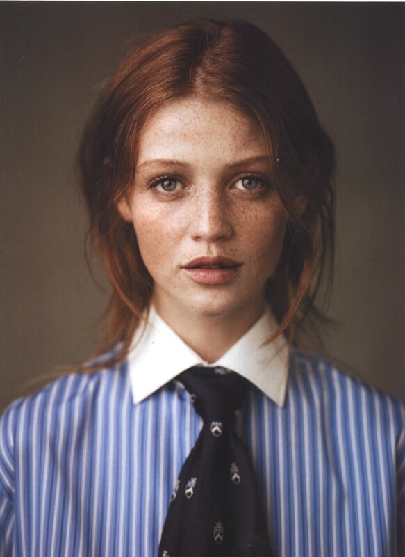 woman with freckles in striped shirt