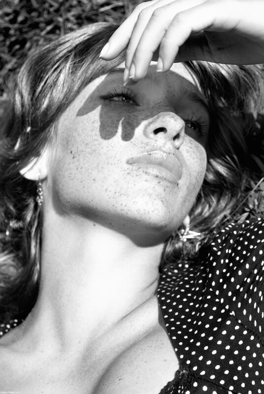 woman with freckles in sunlight