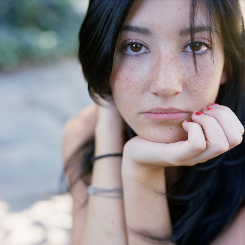 woman with freckles resting chin