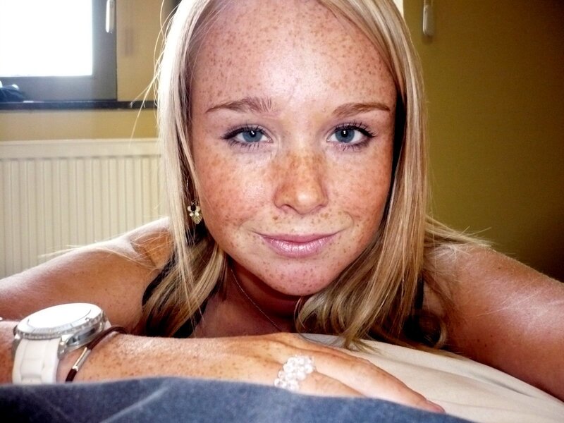 woman with freckles smiling