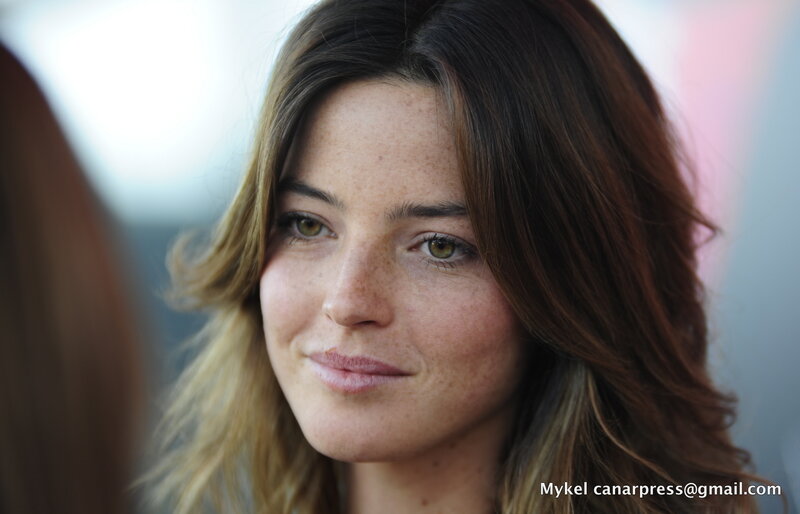 woman with freckles smiling