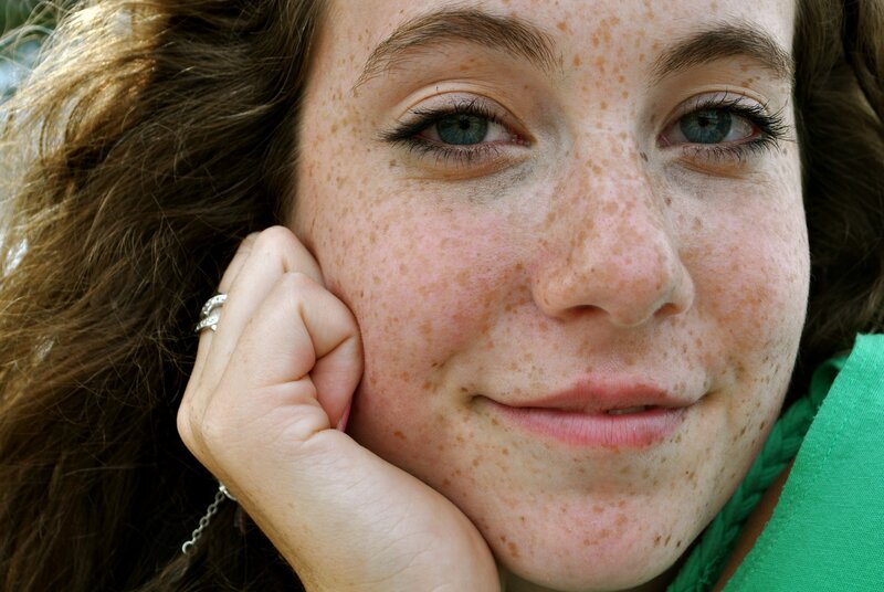 woman with freckles smiling