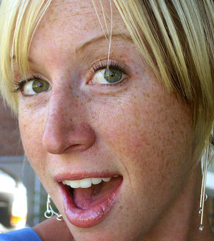 woman with freckles smiling
