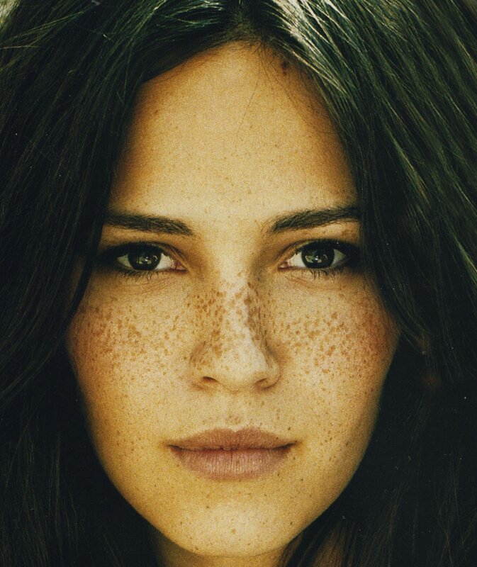 woman with freckles