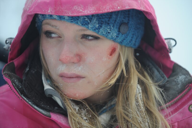 woman with frostbite in snow