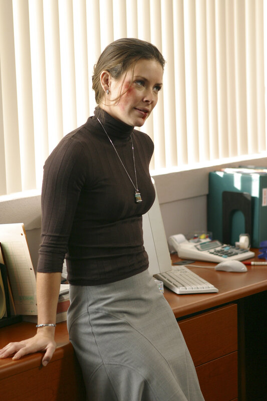 woman with injury in office