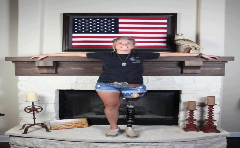 Woman with Prosthetic Leg — White