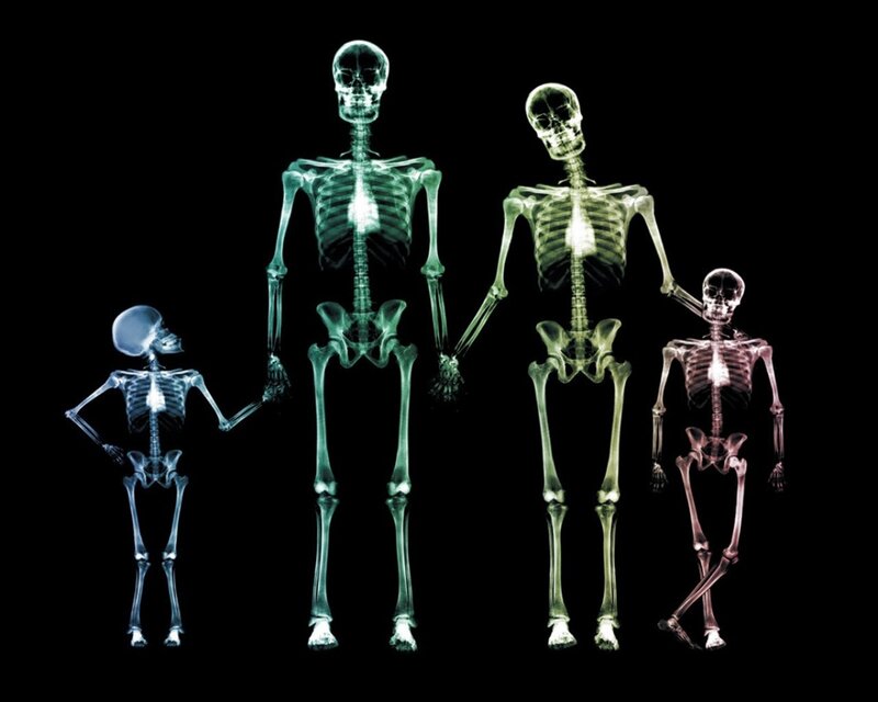 X-ray family skeletons