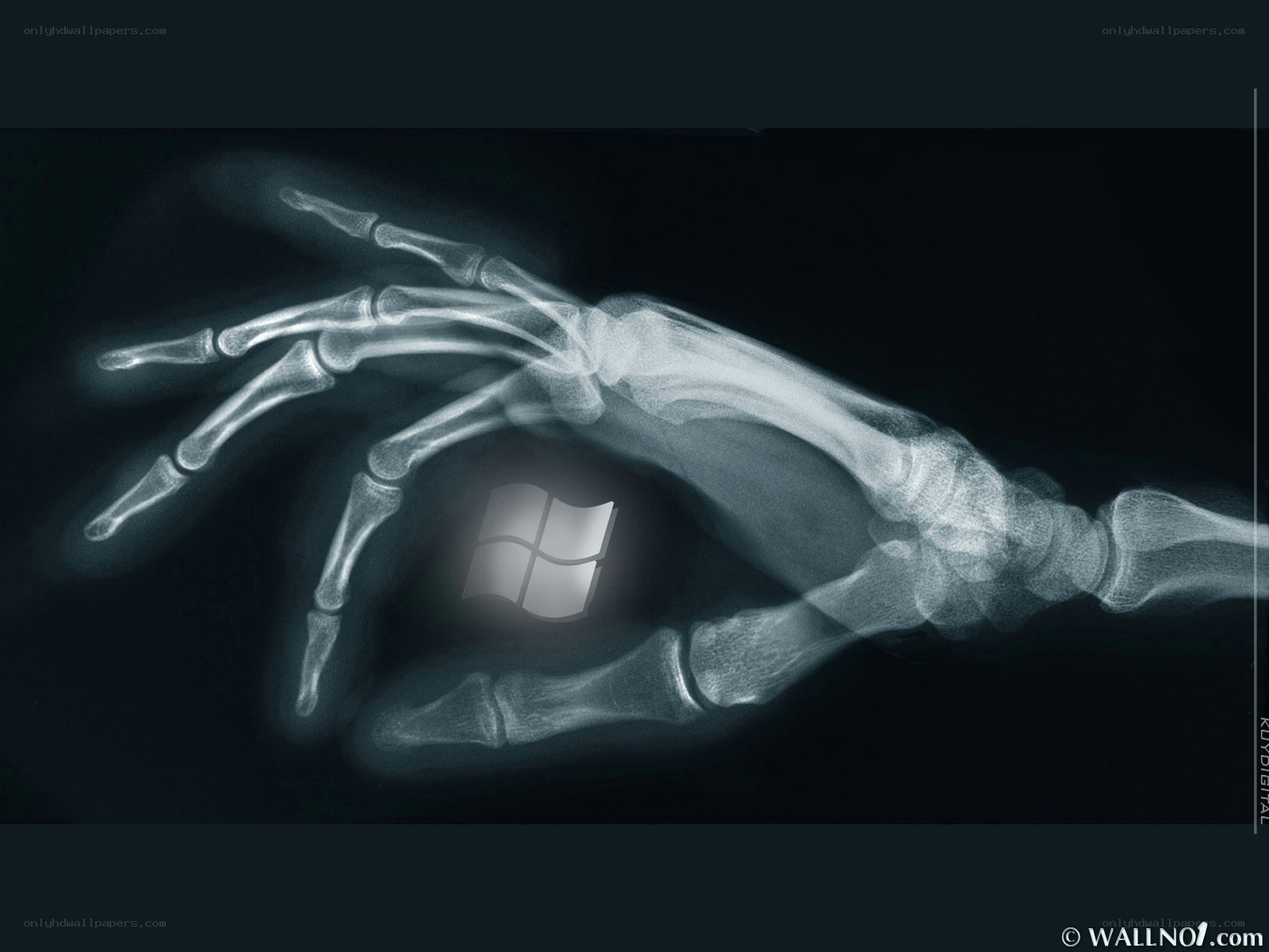 X-ray hand holding Windows logo