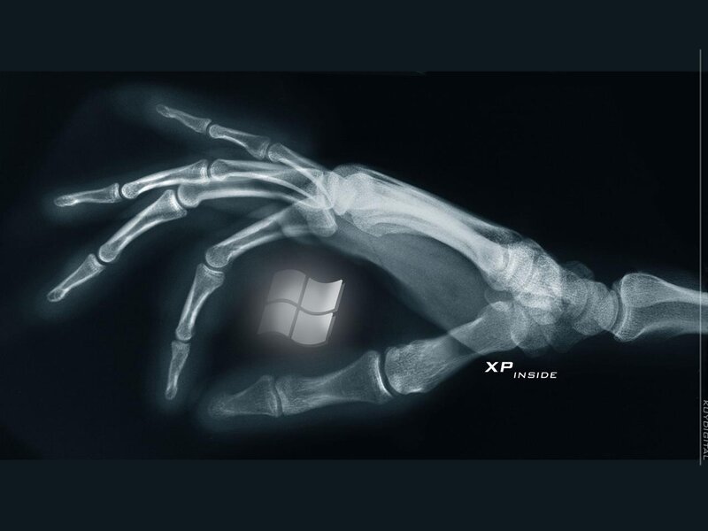 X-ray hand with Windows XP logo