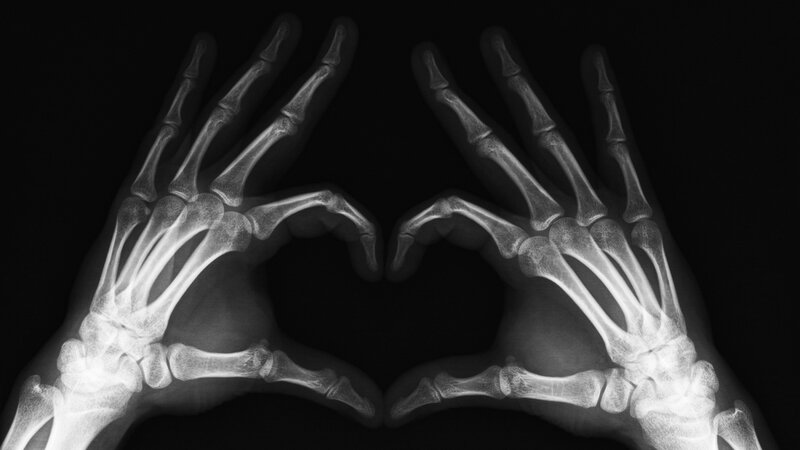 X-ray hands forming heart