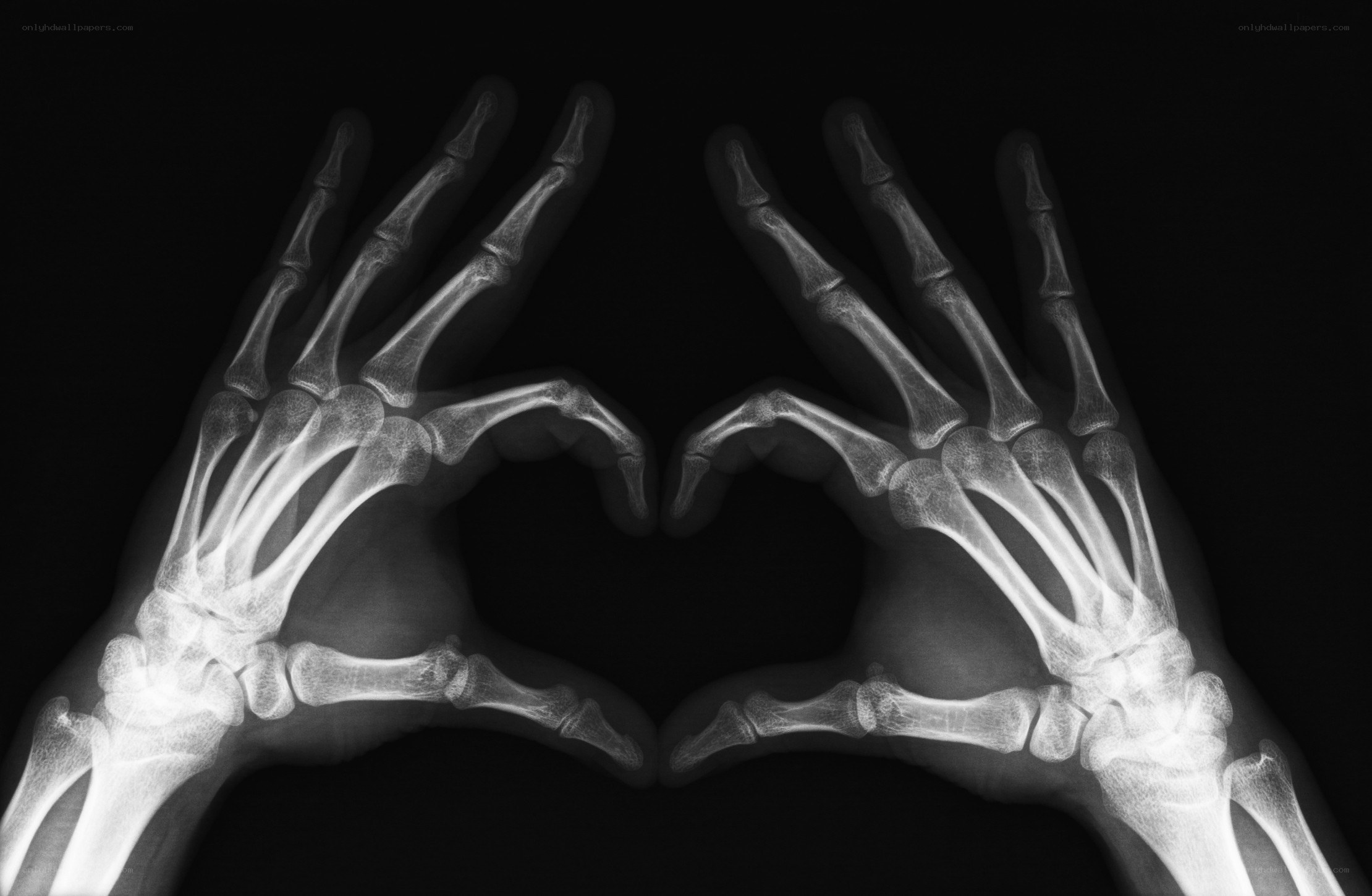 X-ray hands forming heart