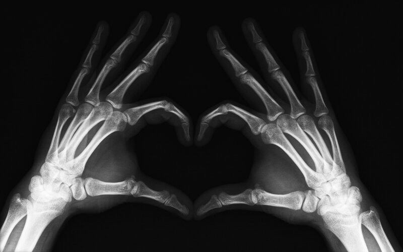 X-ray hands forming heart