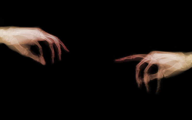 X-ray hands reaching