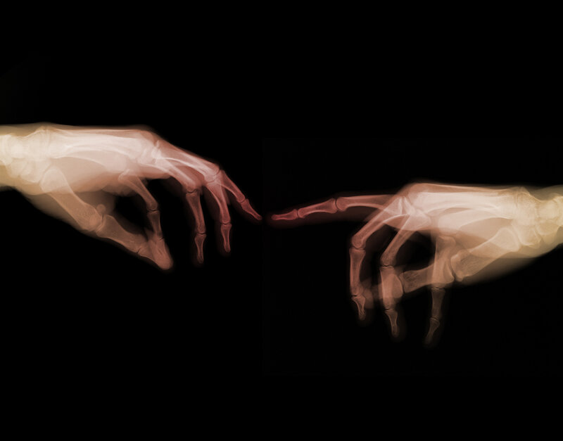 X-ray hands reaching