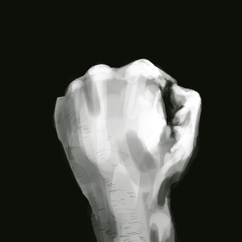 X-ray of a clenched fist