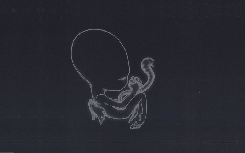X-ray of a fetus
