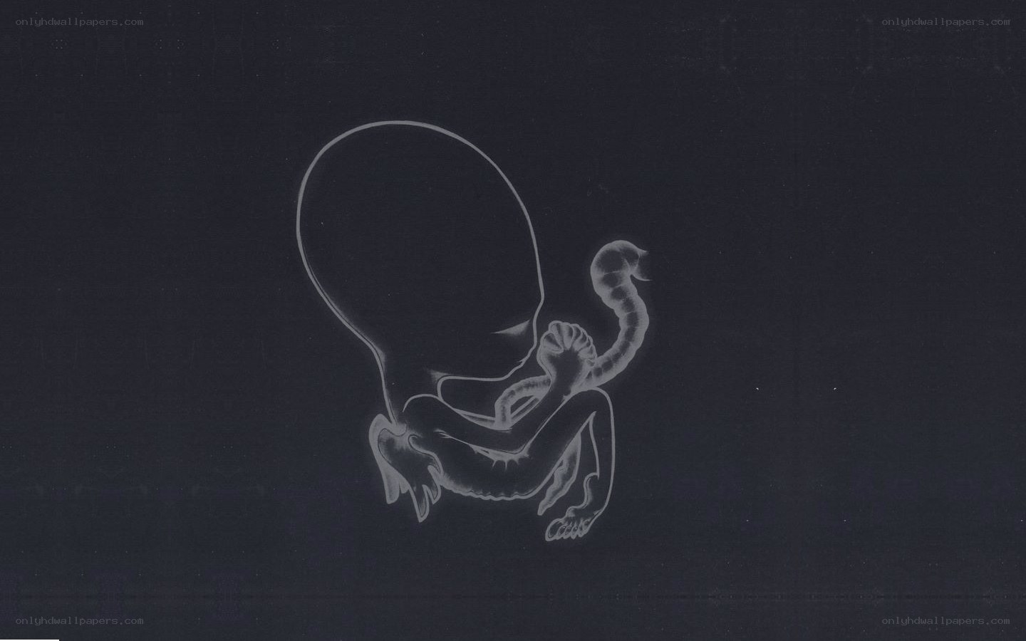 X-ray of a fetus
