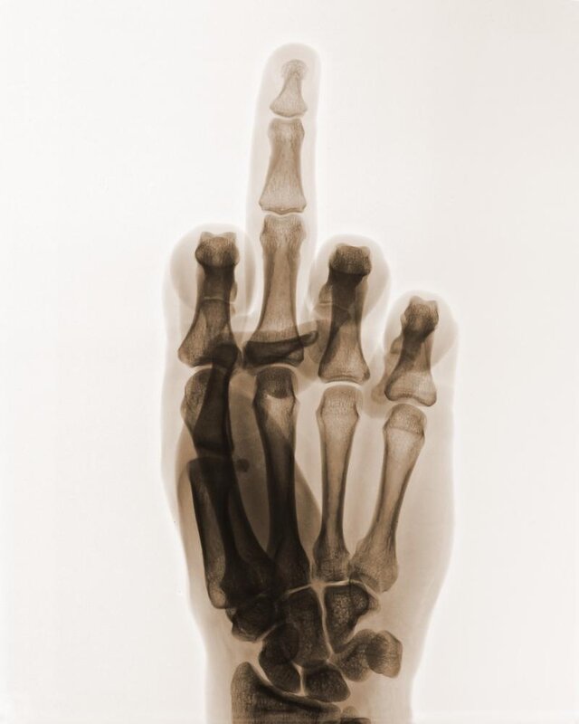 X-ray of a hand making a gesture