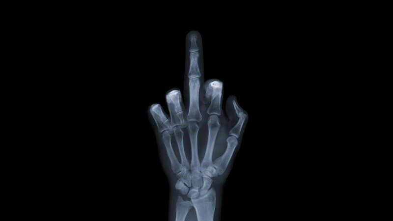 X-ray of a hand making an offensive gesture