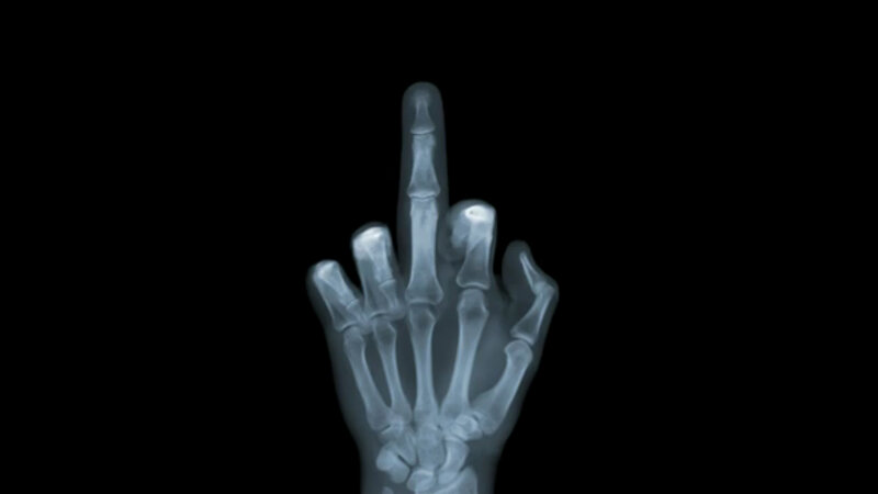 X-ray of a hand making an offensive gesture