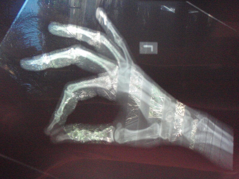 X-ray of a Hand