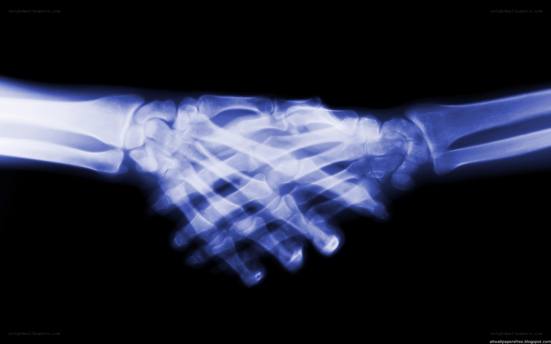 X-ray of a handshake