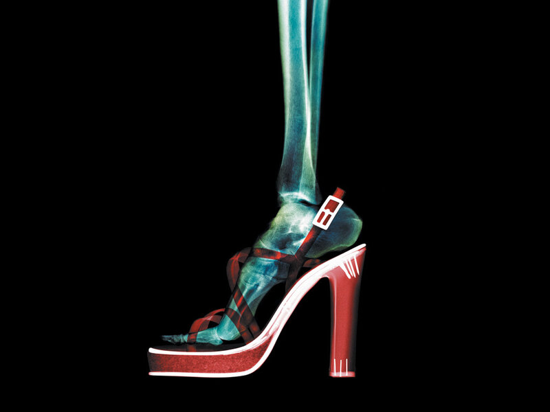 X-ray of a high-heeled shoe