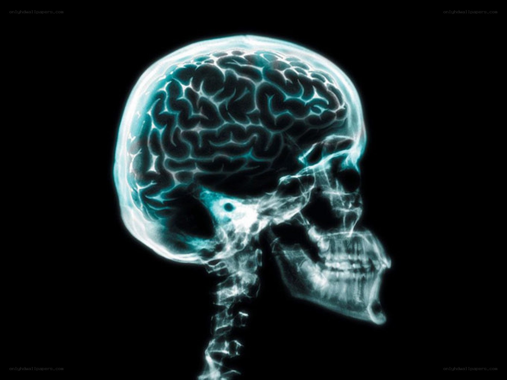 X-ray of a human brain