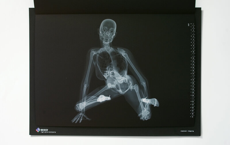 X-ray of a human skeleton