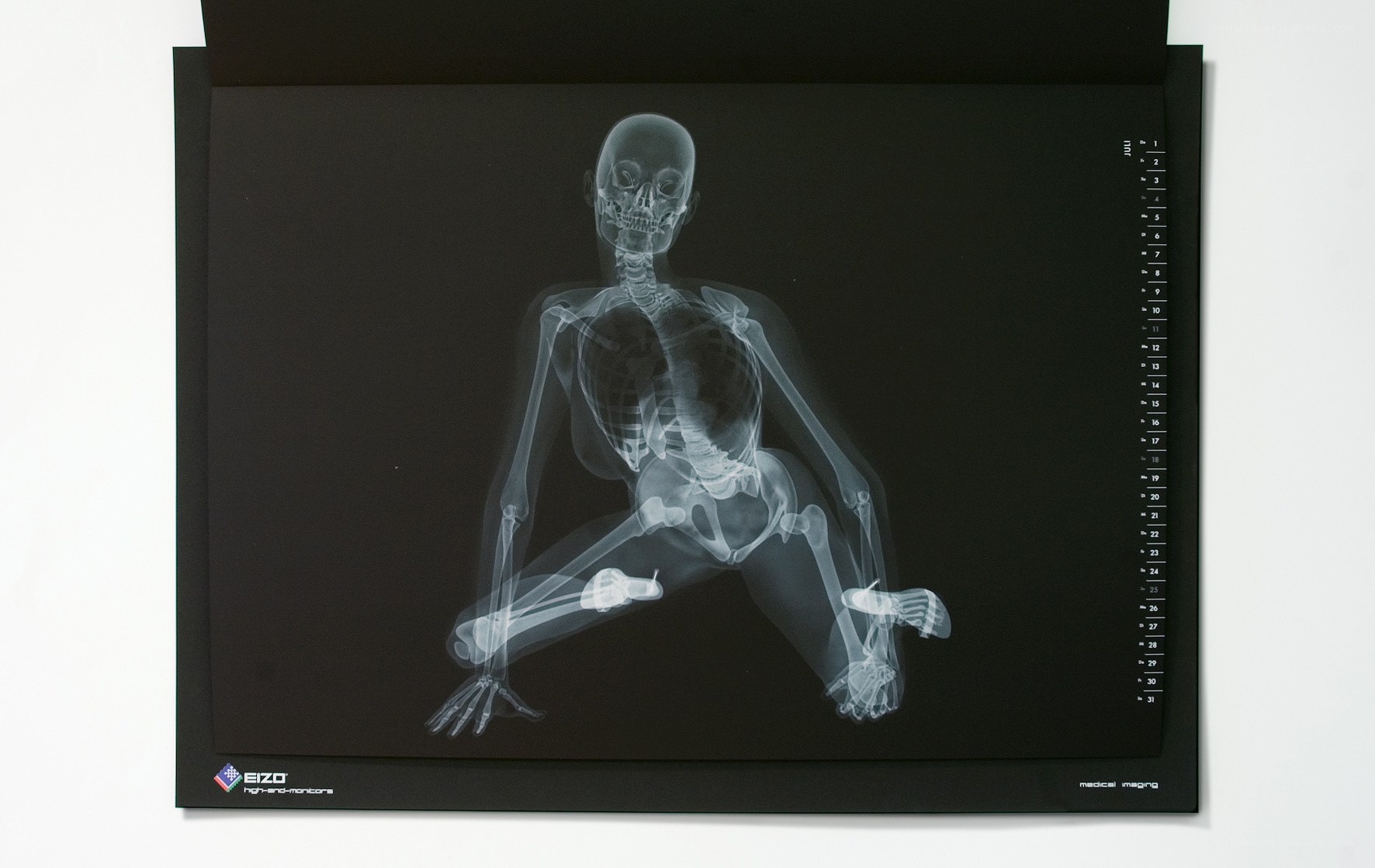 X-ray of a human skeleton
