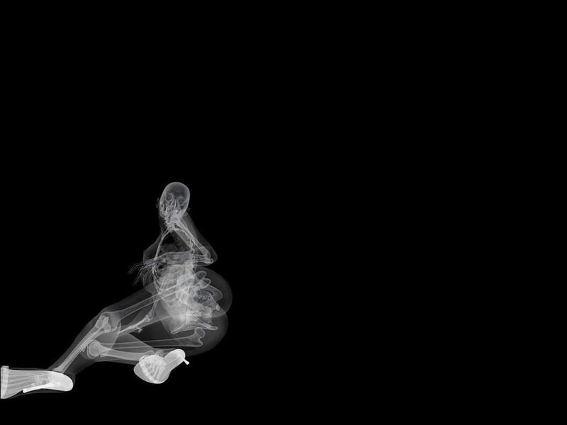 X-ray of a seated figure