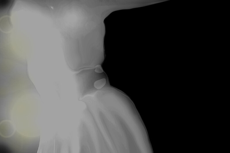 X-ray of a Shoulder