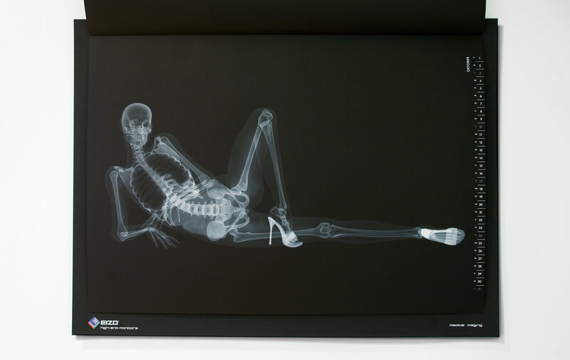 X-ray of a skeleton in high heels