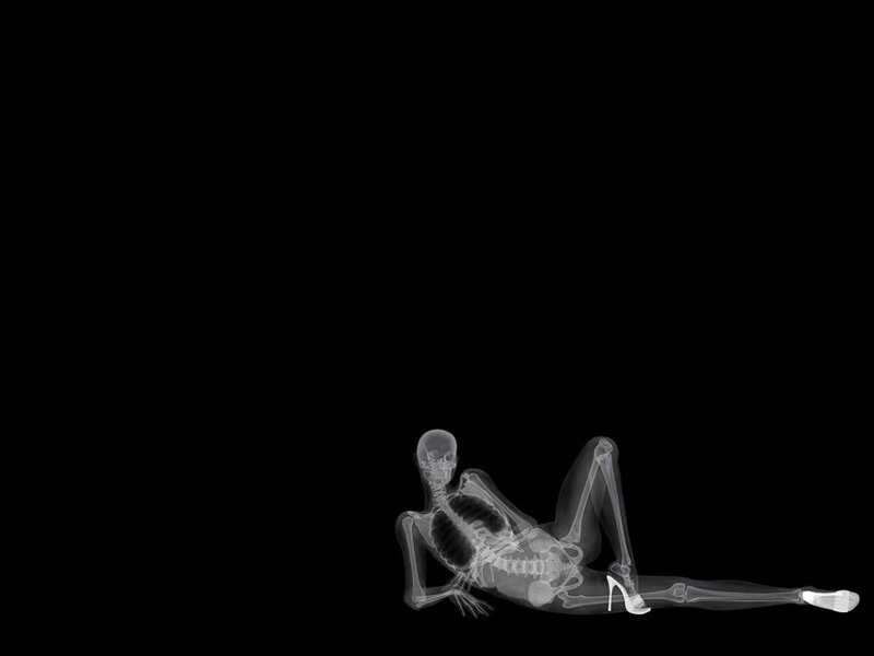 X-ray of a skeleton in high heels