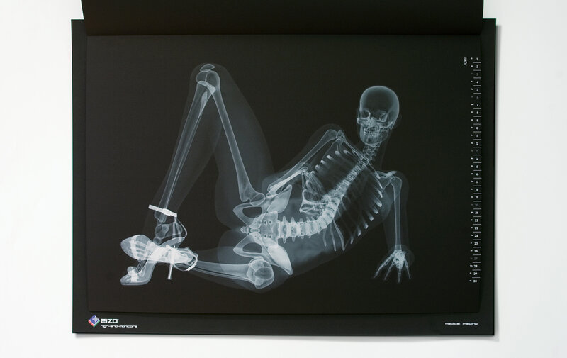 X-ray of a skeleton in high heels