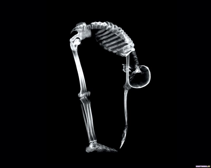 X-ray of a skeleton in yoga pose