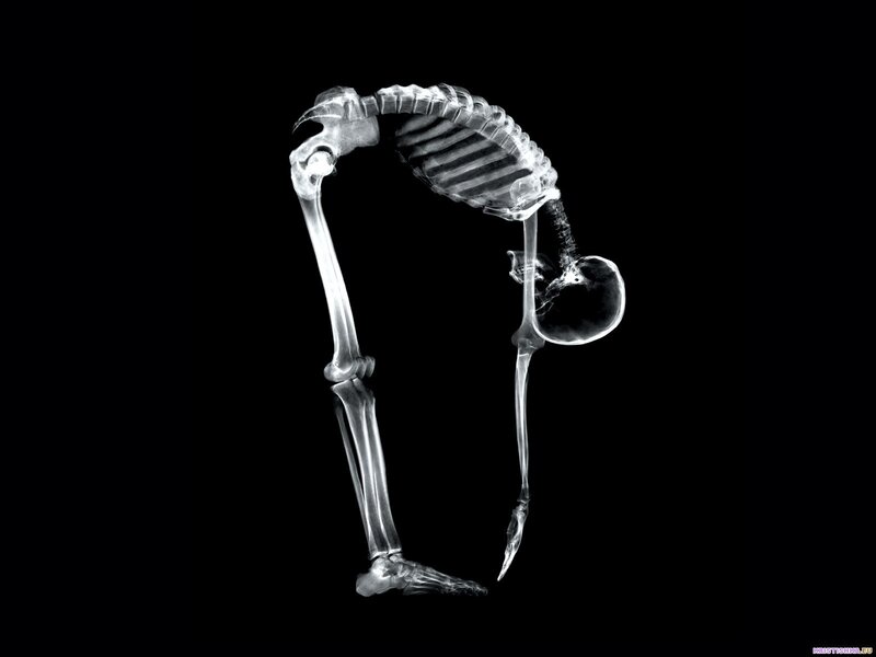 X-ray of a skeleton in yoga pose