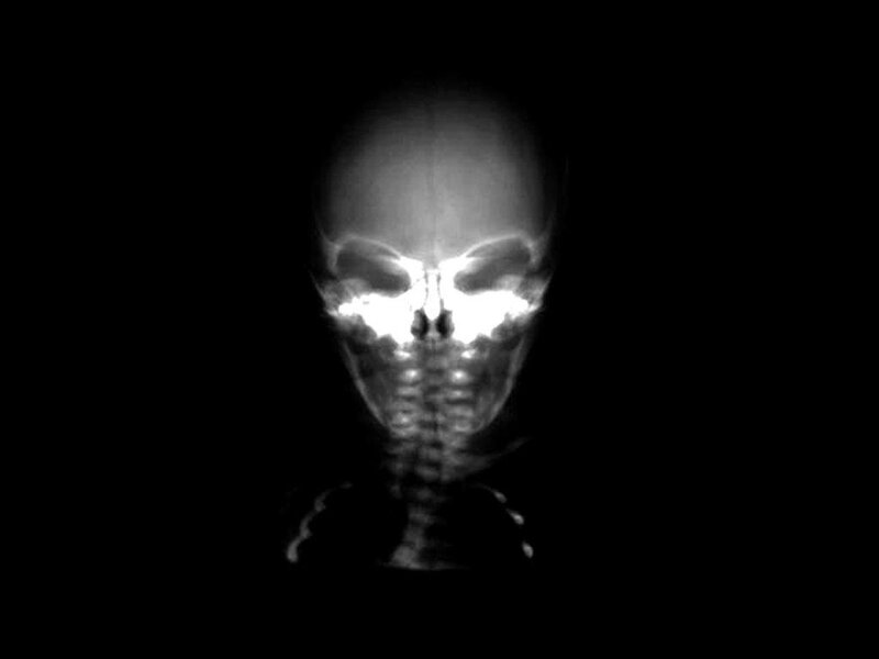 X-ray of a Skull — Black, Dark