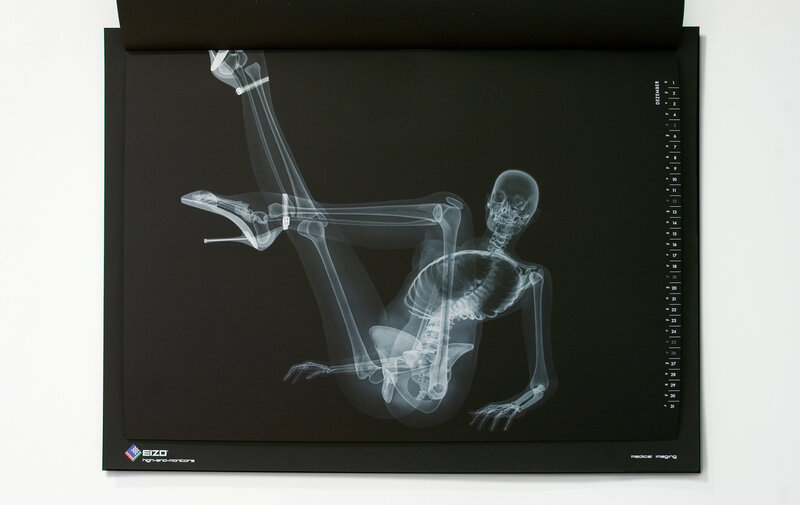 X-ray of a woman in high heels