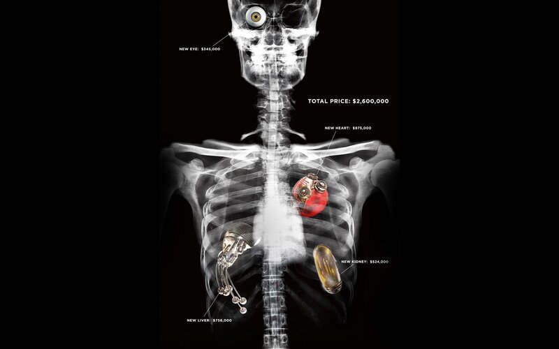 X-ray of artificial organs