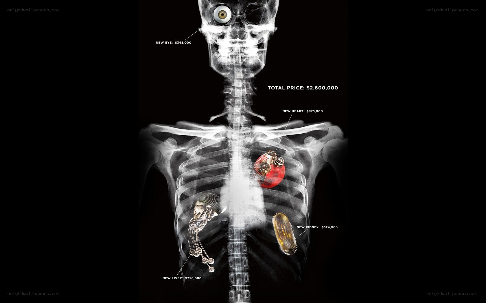 X-ray of artificial organs